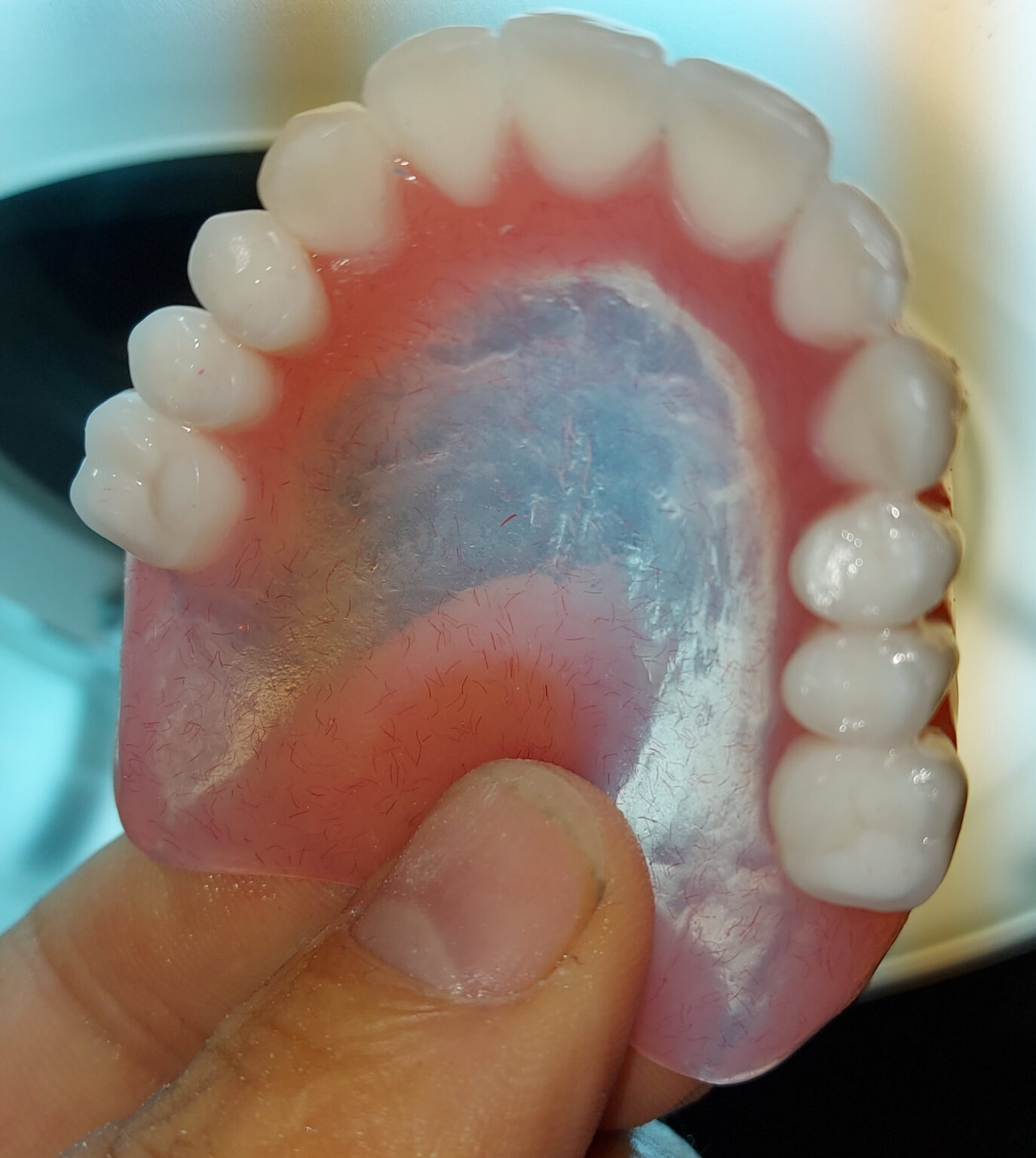 Protesi totali flessibili e leggere.Novità Centri Dental.it