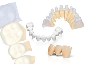 ceramiche dentali differenze